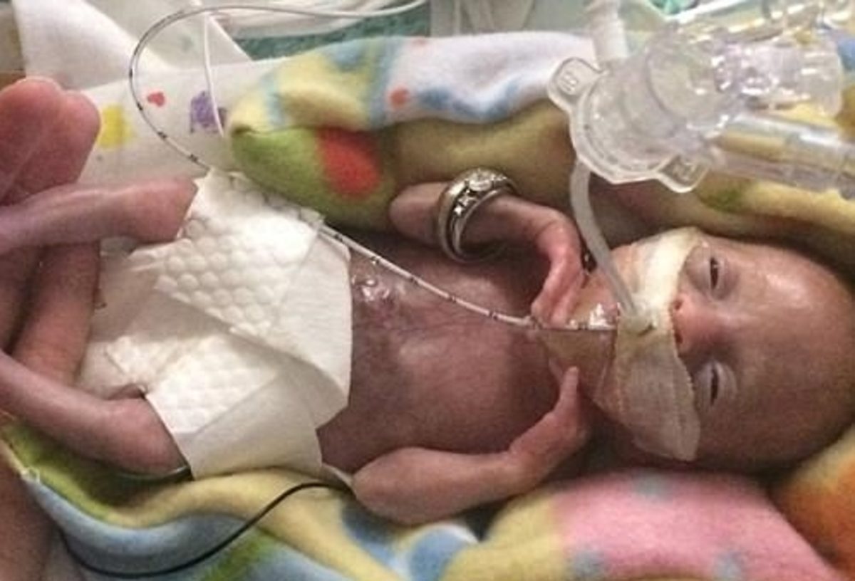 πρόωρο βρέφος