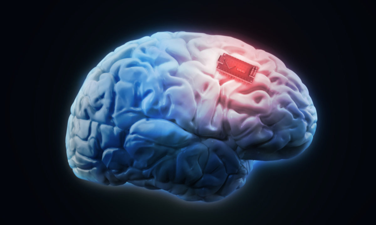 εγκεφαλικά εμφυτεύματα