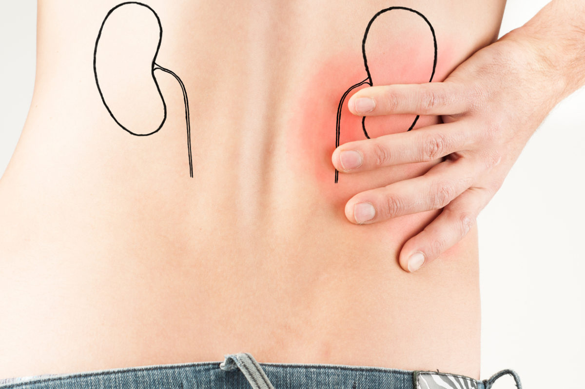 κολικός νεφρού