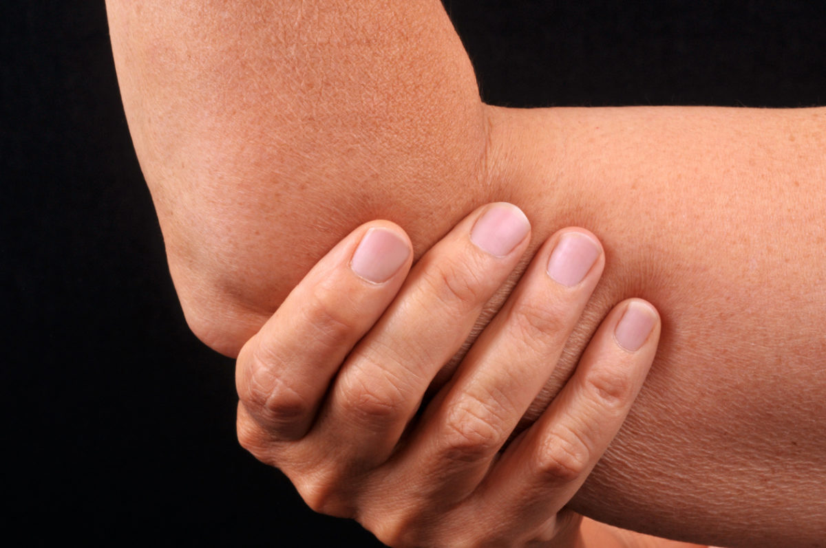 ρευματοειδής αρθρίτιδα