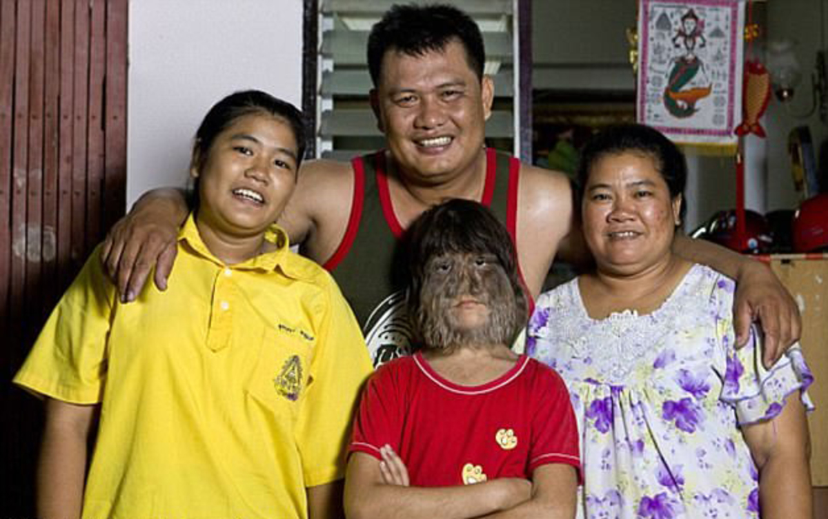 λυκάνθρωπος