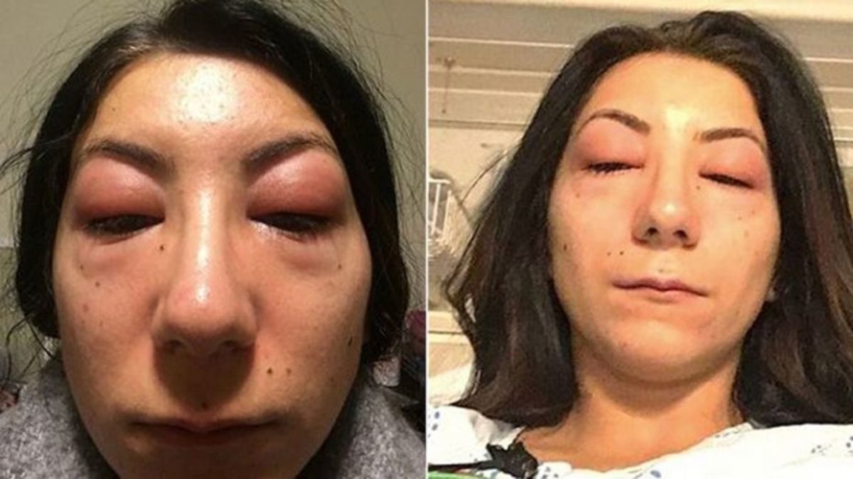 ψεύτικες βλεφαρίδες