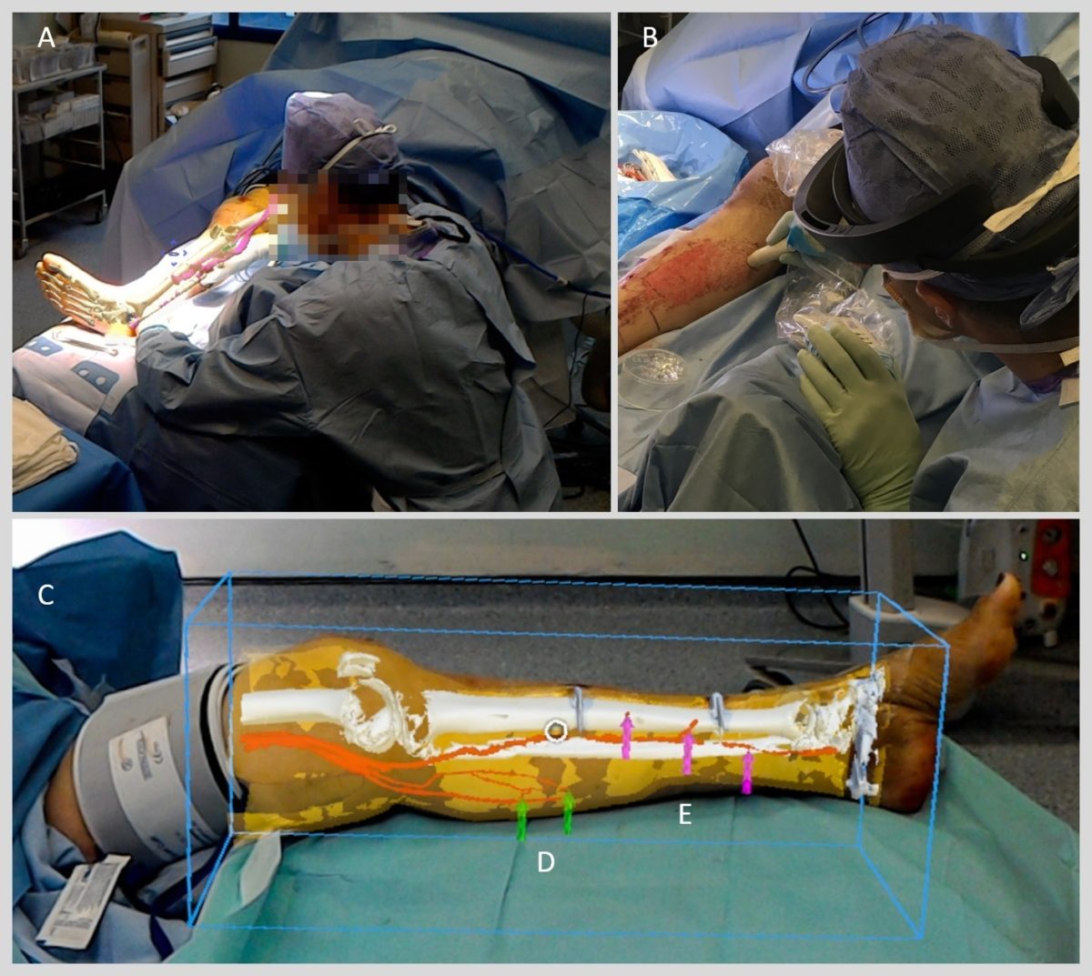 χειρουργική επέμβαση