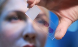 παιδικός καρκίνος