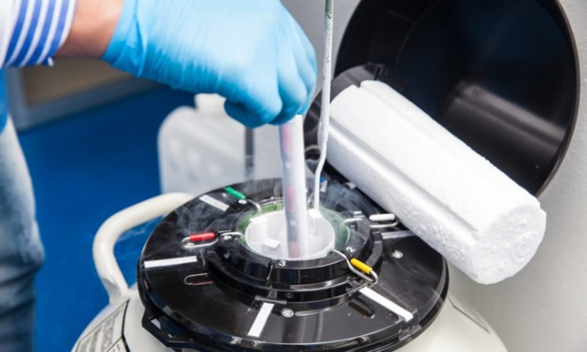 τράπεζα σπέρματος