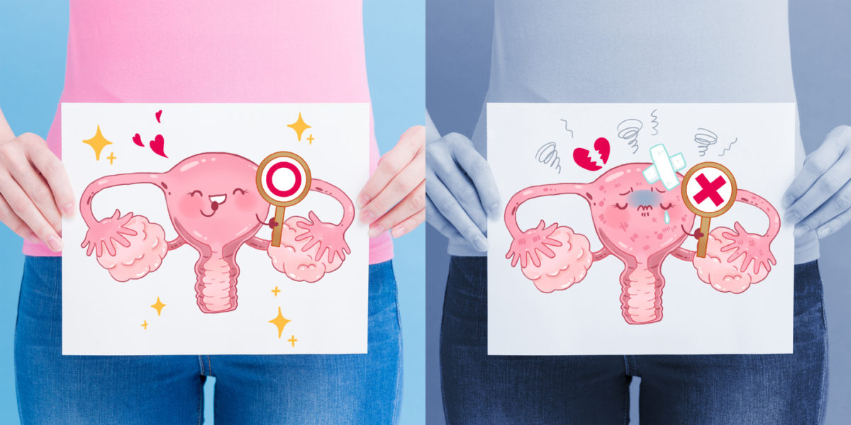 καρκίνος των ωοθηκών