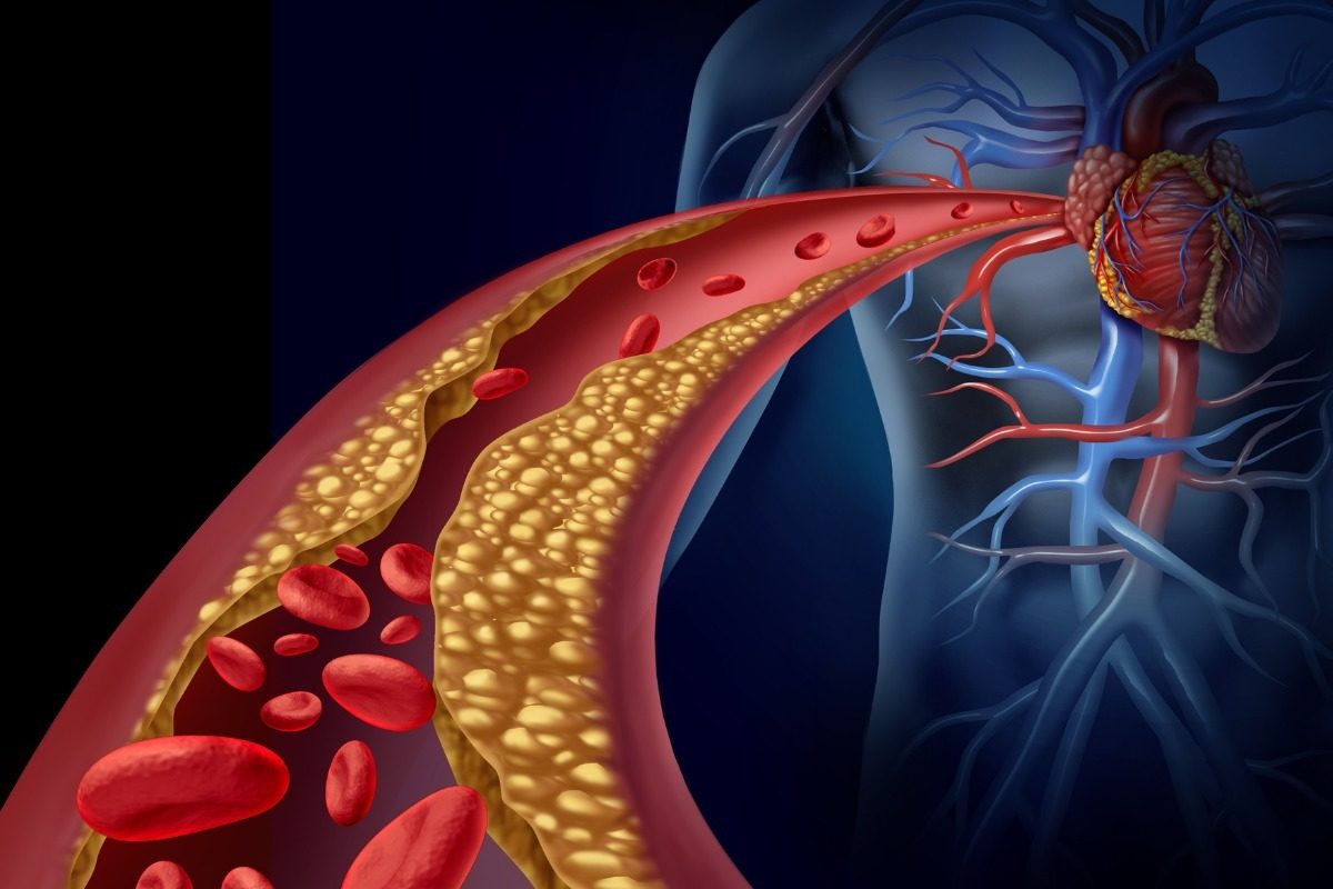 χοληστερόλη