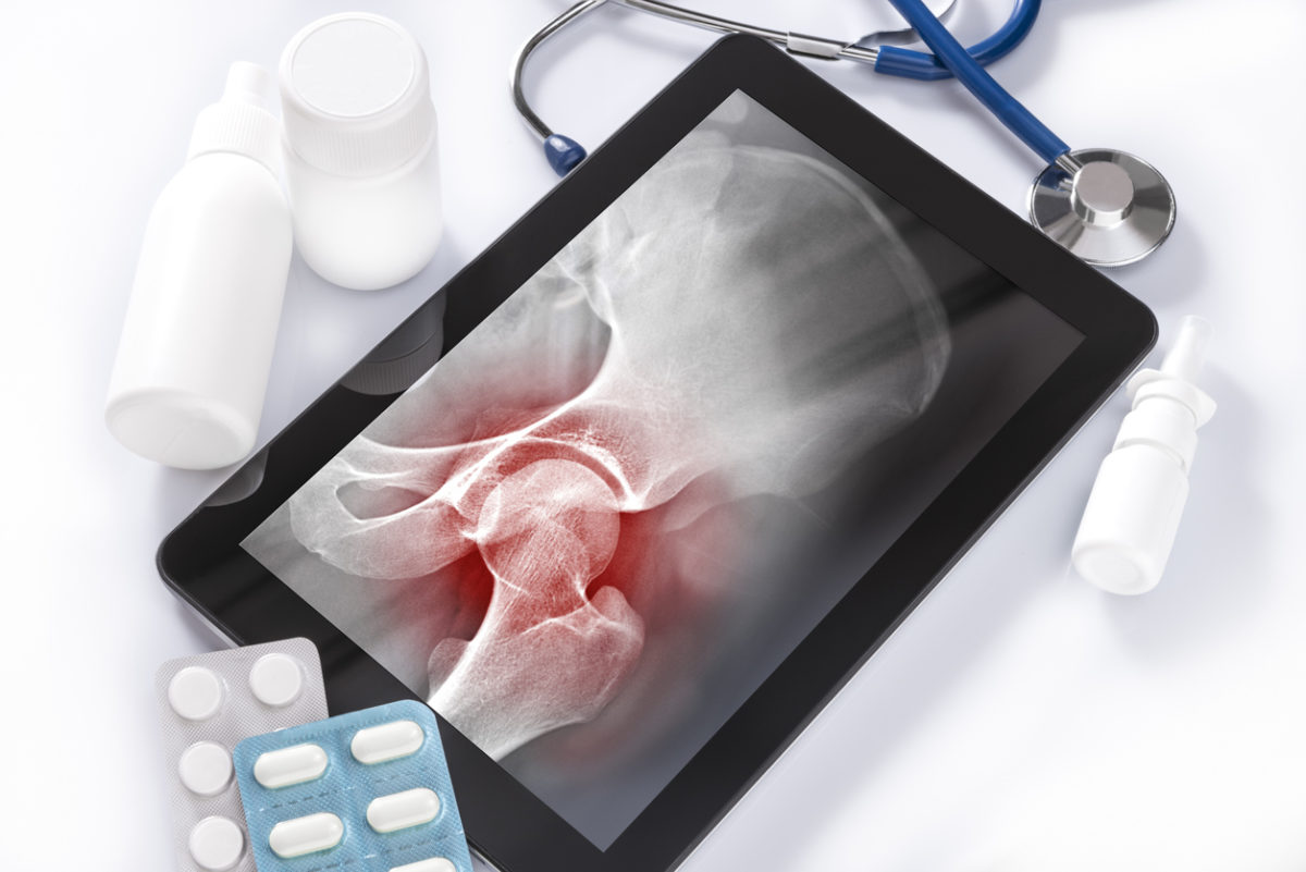 οστεοσάρκωμα