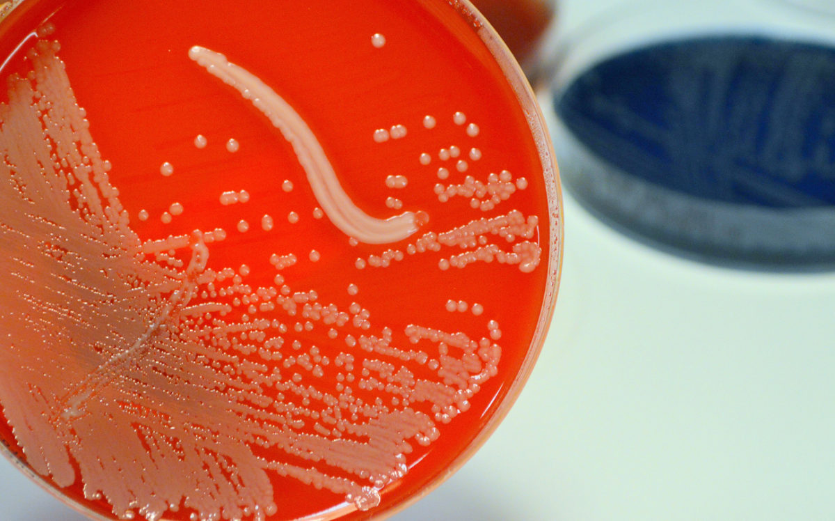 σταφυλόκοκκος