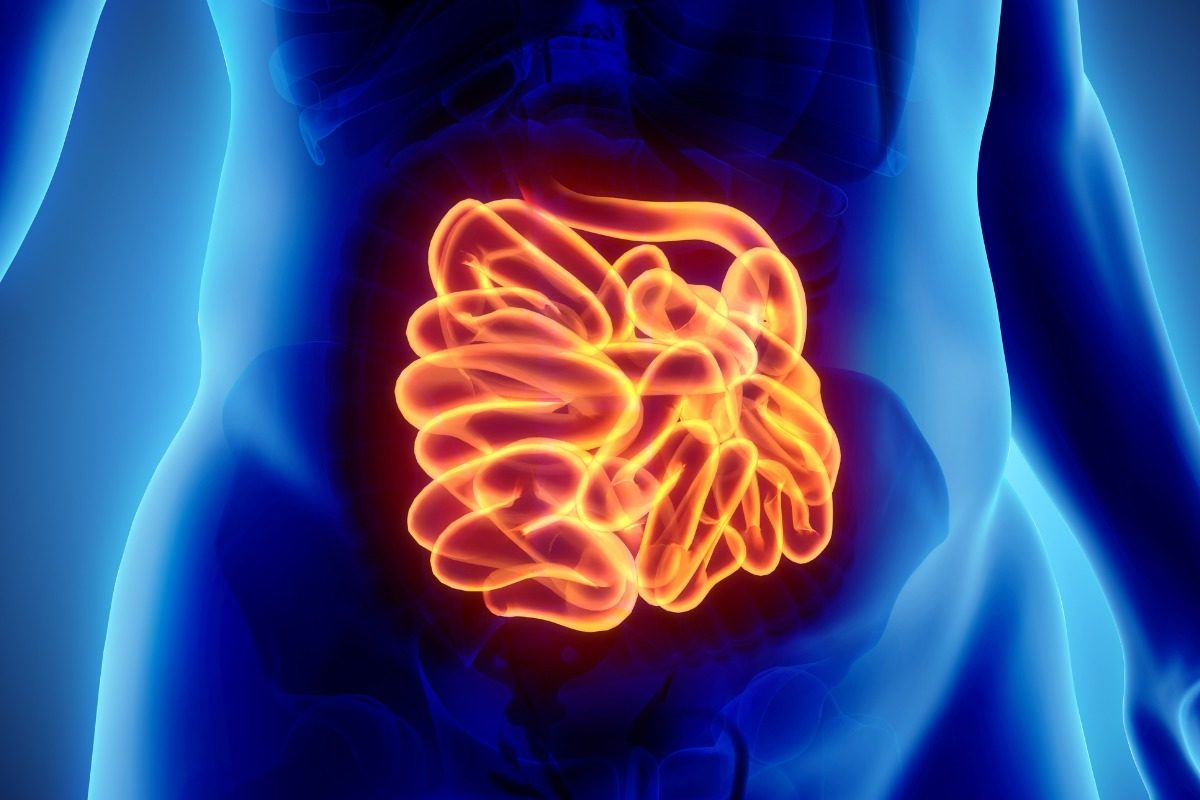 Καρκίνος του παχέος εντέρου