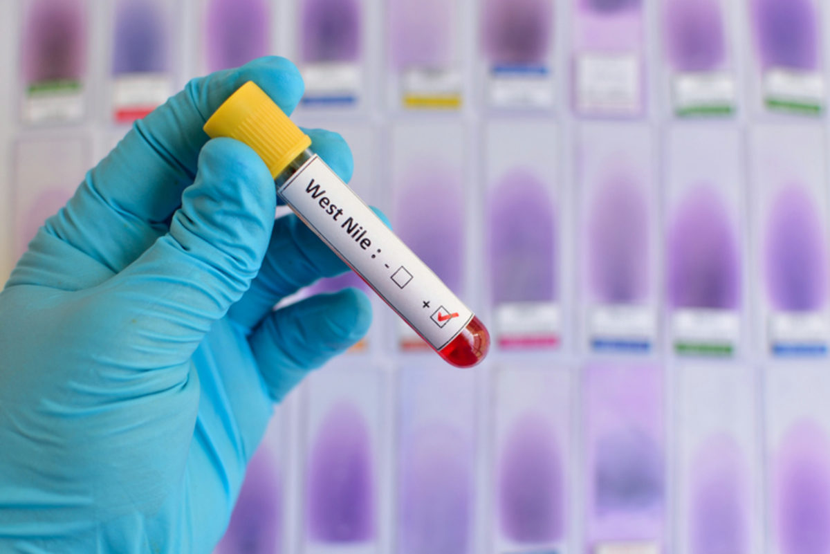 ιός του Δυτικού Νείλου