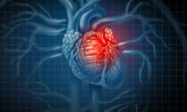 καρδιακή προσβολή