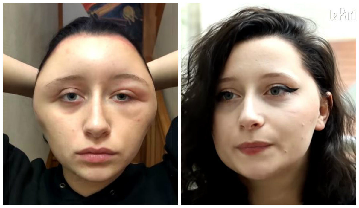 βαφή μαλλιών