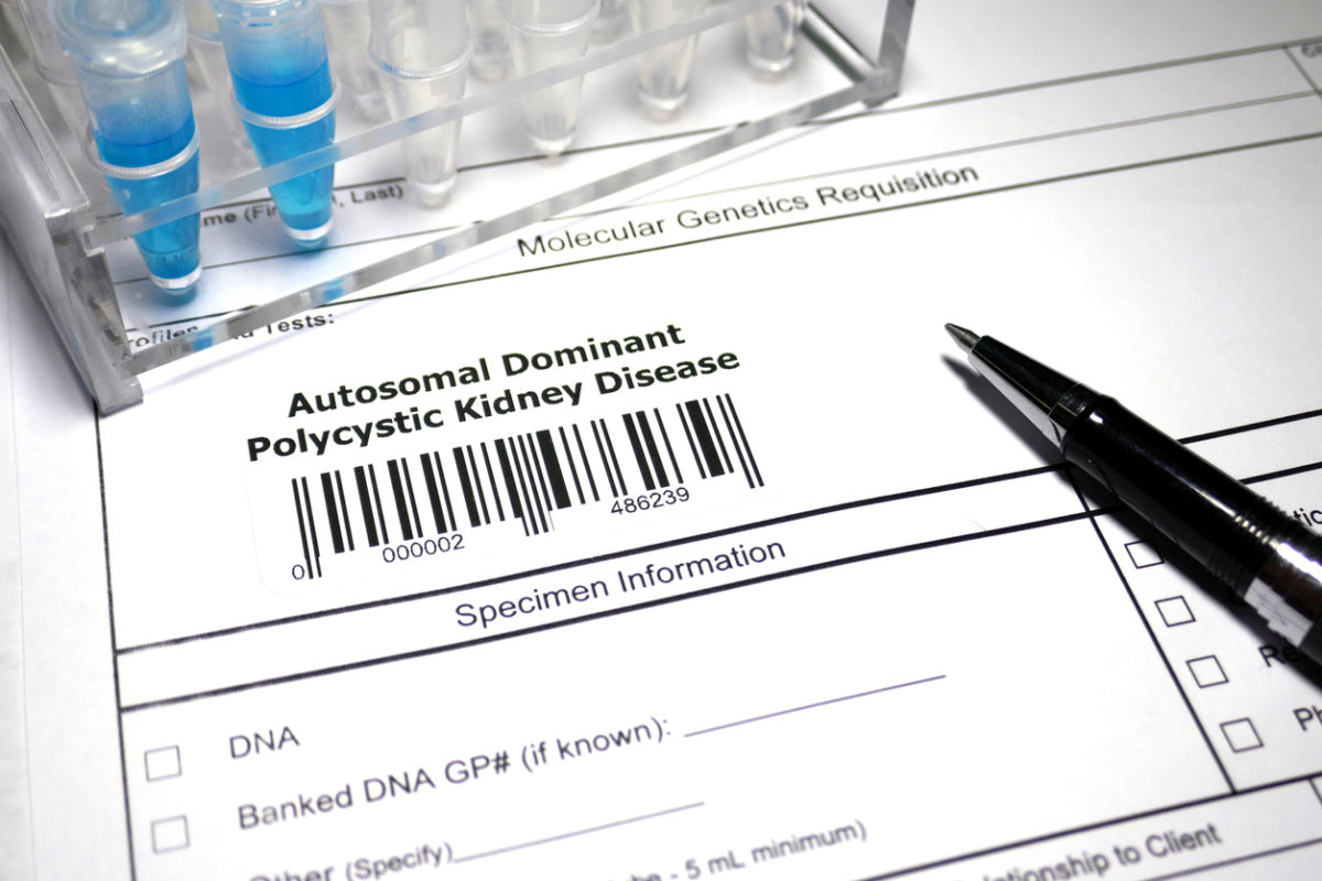 χρόνια νεφρική νόσος