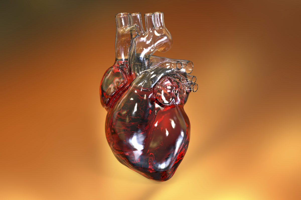 στένωση αορτής