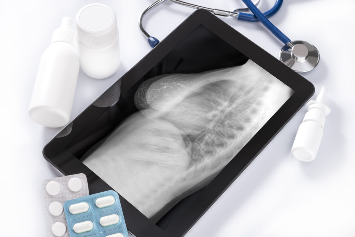 ψηφιακή μαστογραφία