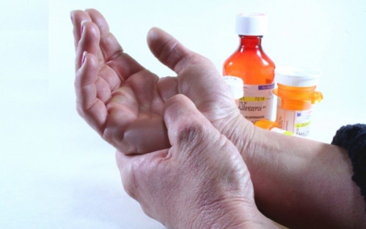 ρευματοπαθείς