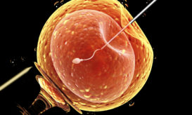 εξωσωματική γονιμοποίηση