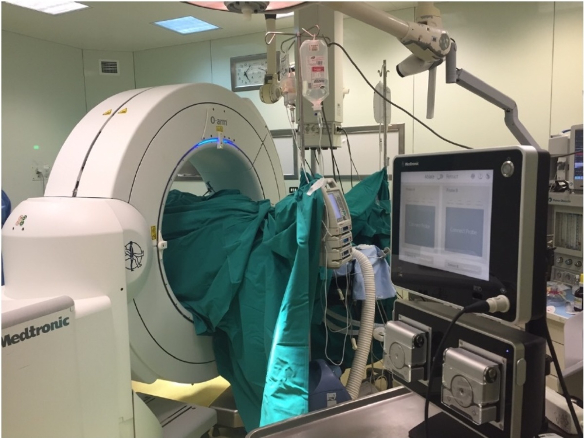 σπονδυλική στήλη