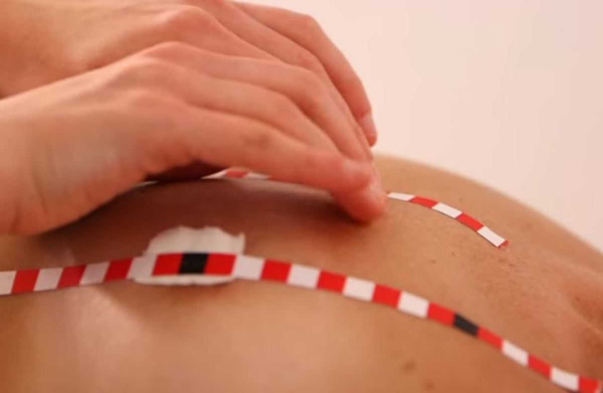 καρκίνος του μαστού