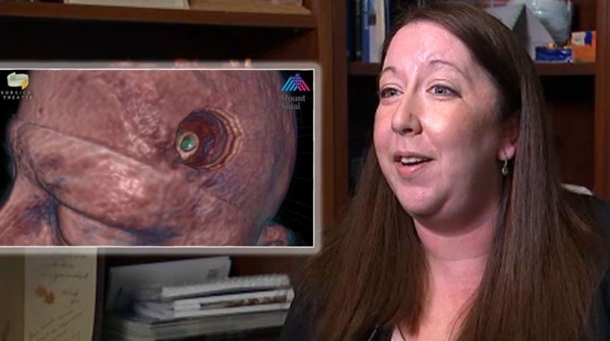 σκουλήκι-ταινία