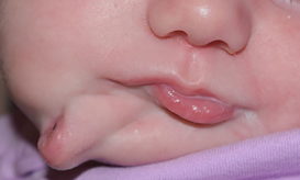 δεύτερο στόμα