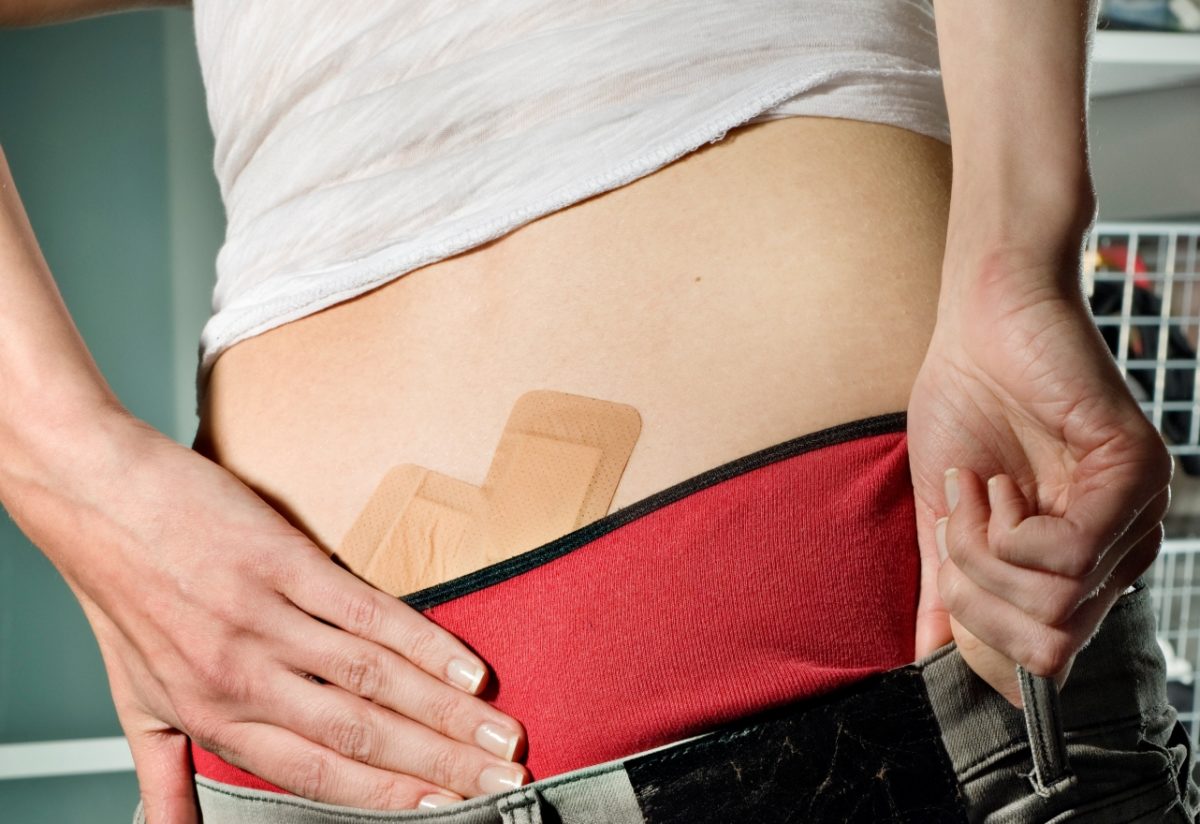 κύστη κόκκυγα