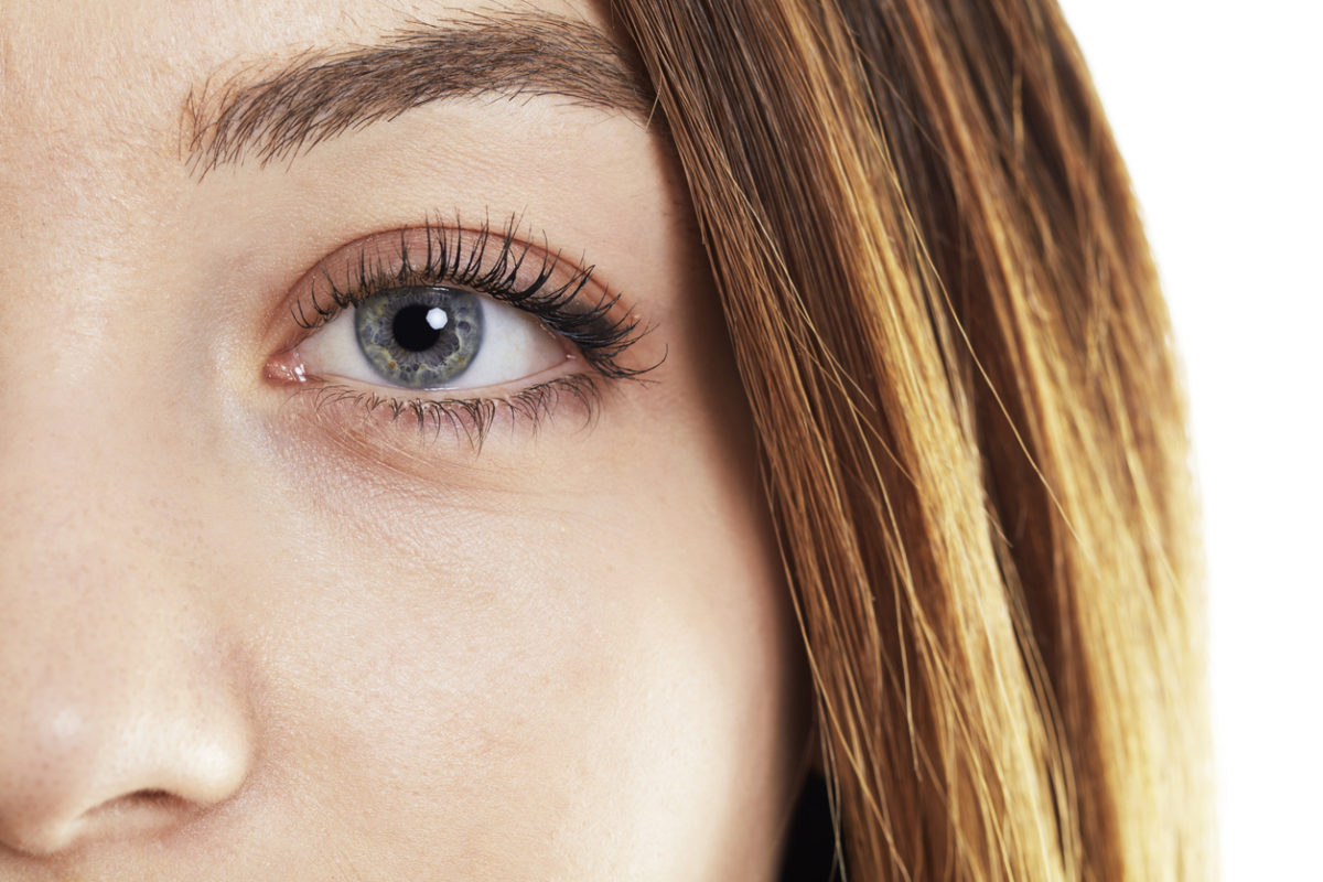 φακίδες στα μάτια