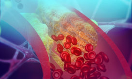 χοληστερίνη