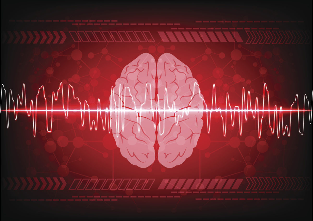 εγκεφαλικό