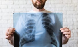 καρκίνος του πνεύμονα