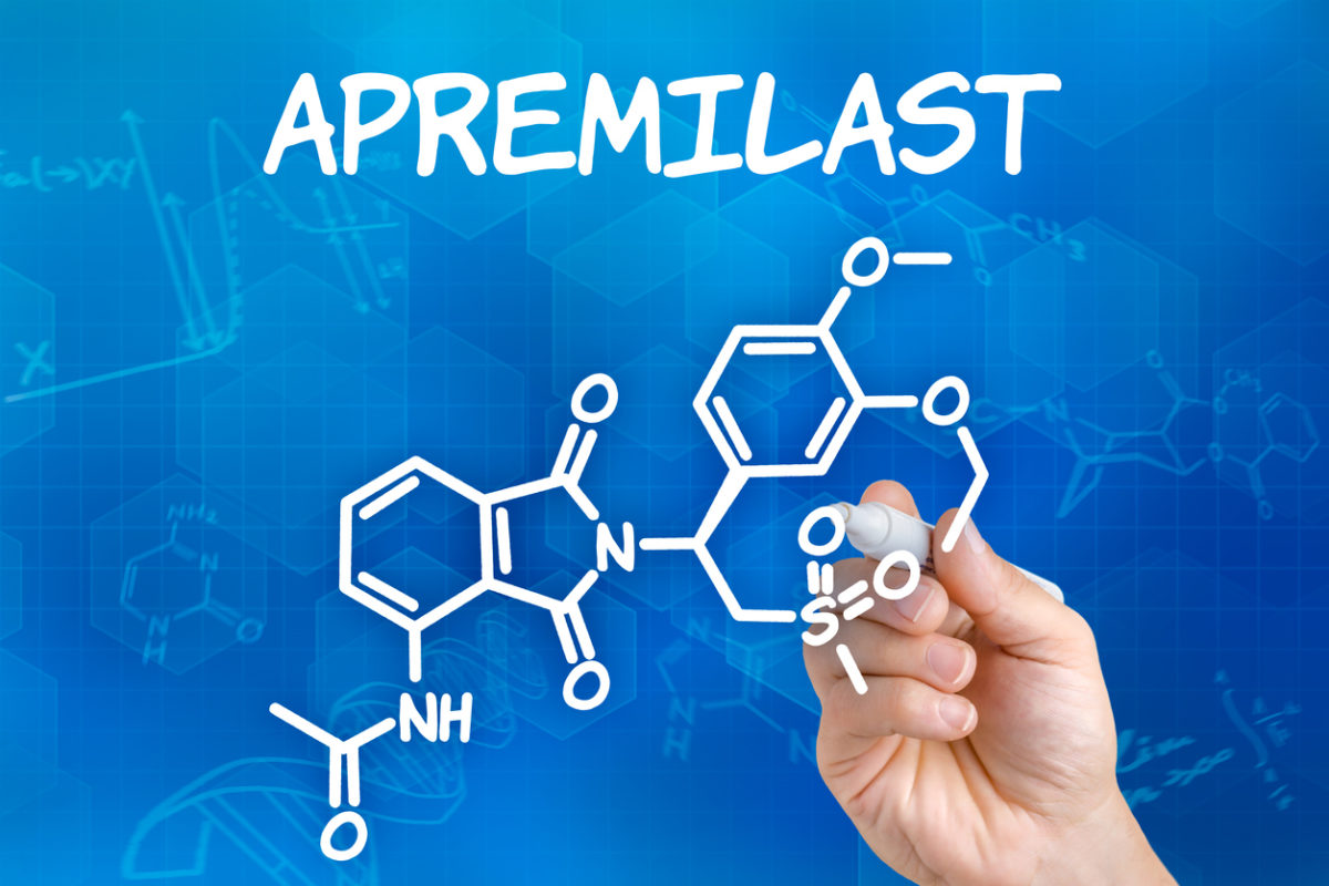 απρεμιλάστη