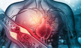 χοληστερόλη