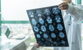 θρομβώσεις