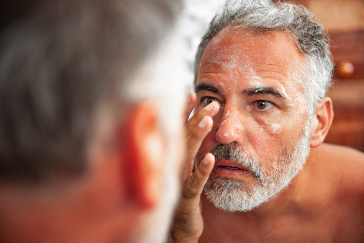 έγκαυμα από τον ήλιο