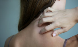 έρπης ζωστήρας