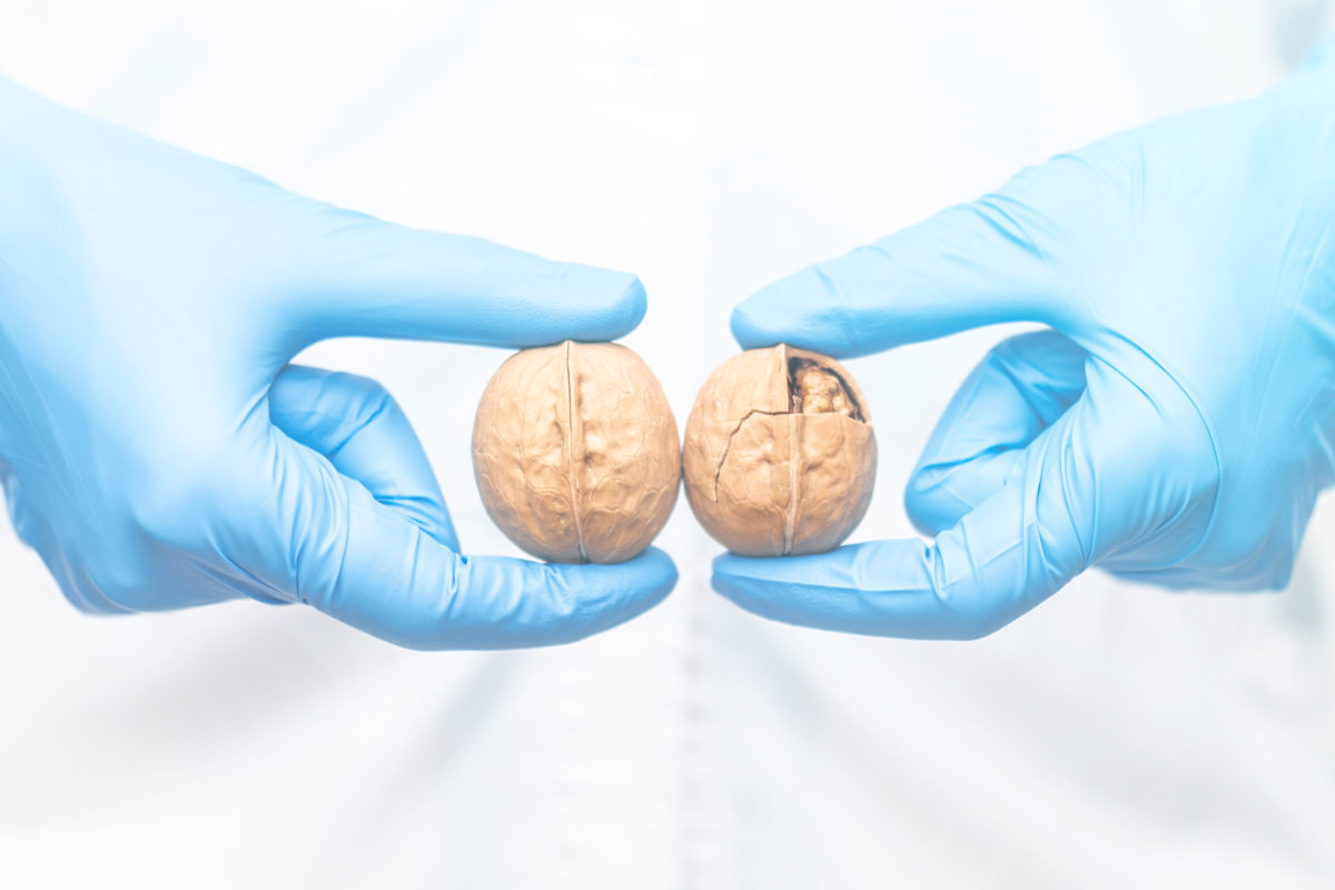 καρκίνος των όρχεων