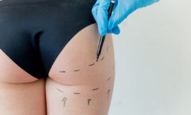 πλαστική επέμβαση