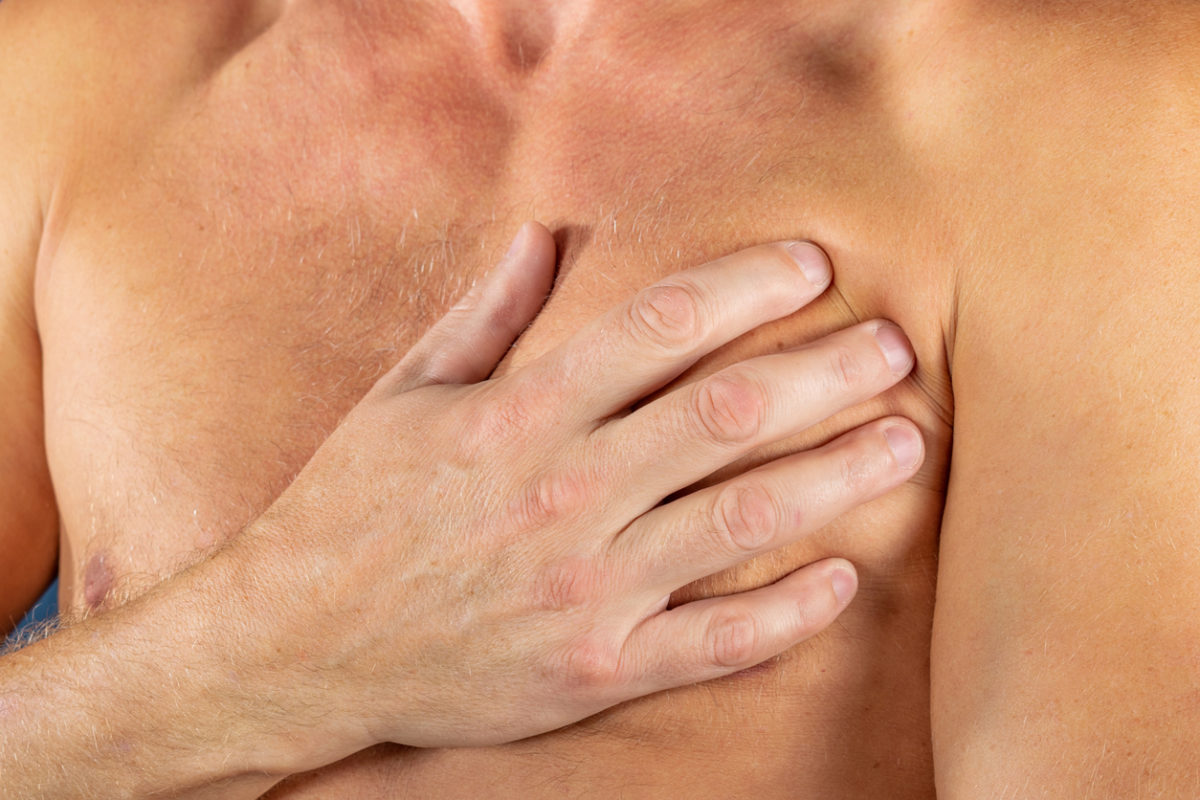 πλευροχονδρίτιδα