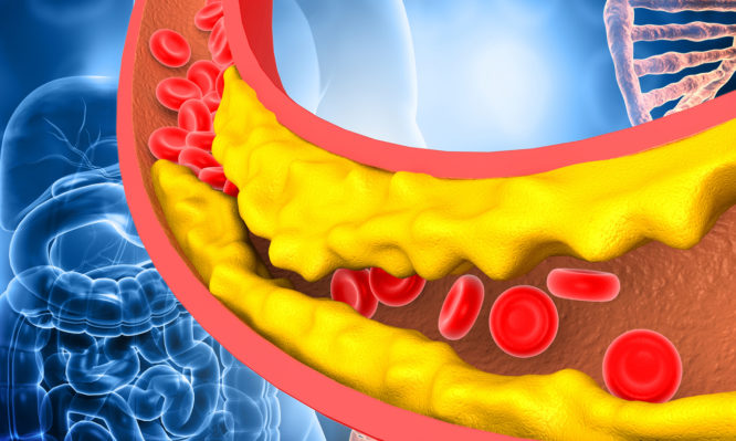 χοληστερόλη