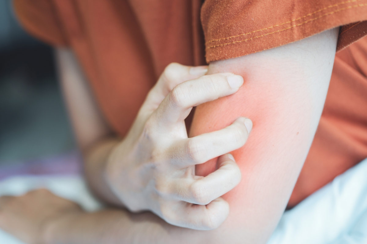 ηπατίτιδα C