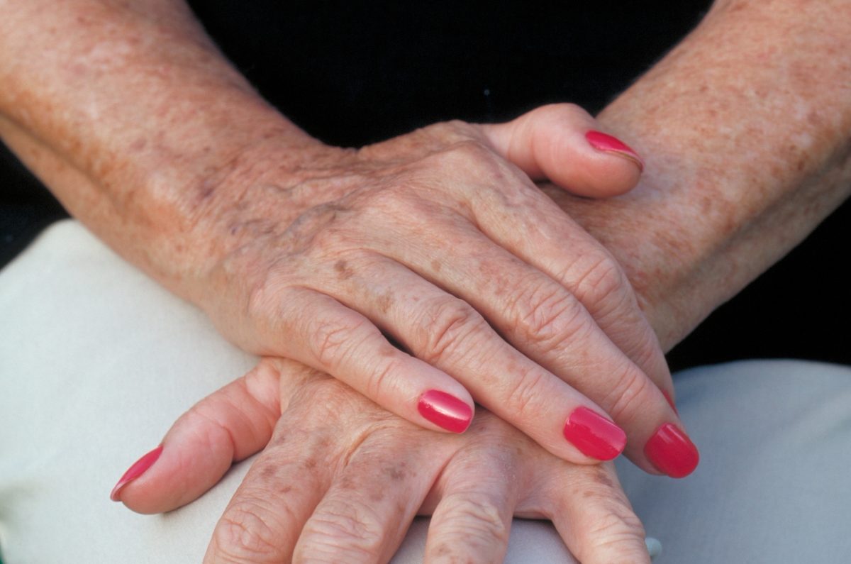 λευκές κηλίδες