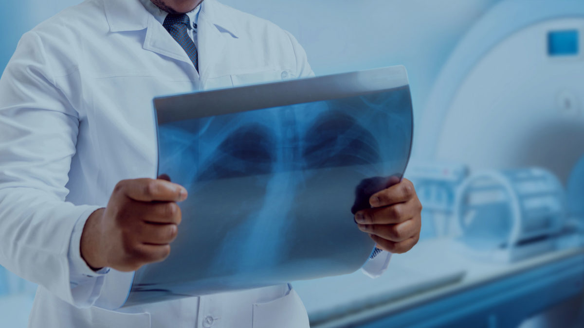 καρκίνος του πνεύμονα