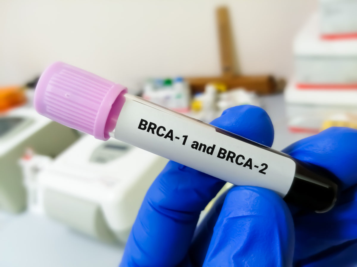 BRCA