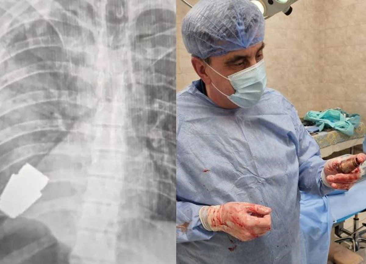 οπλοβομβίδα