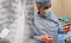 οπλοβομβίδα