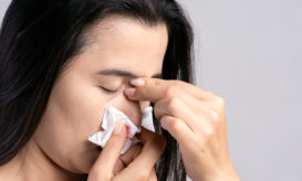 ρινορραγία