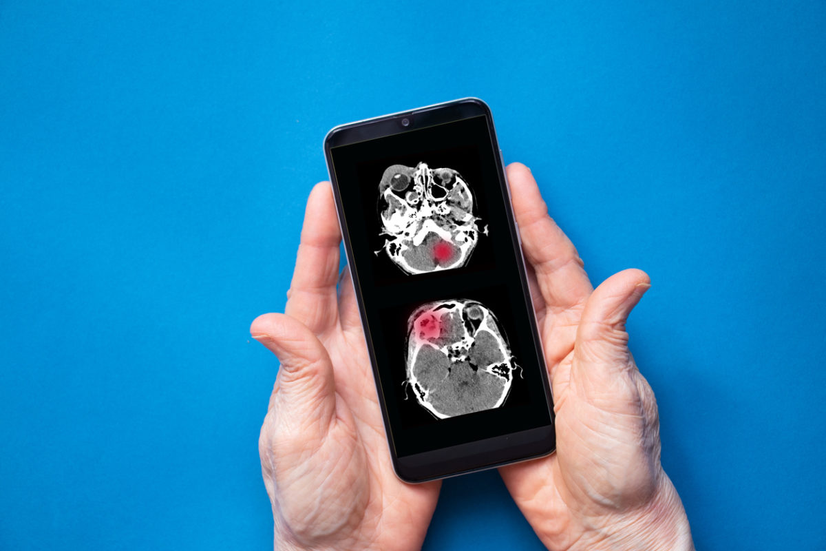 εγκεφαλικό