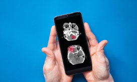 εγκεφαλικό