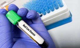 τρελών αγελάδων